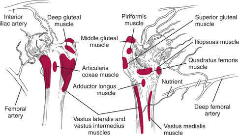 Fractures of the Femur | Veterian Key