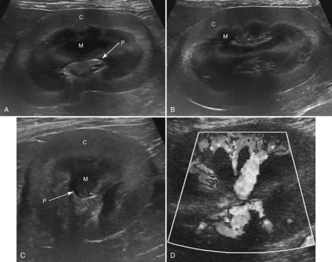 The Kidneys And Ureters Veterian Key