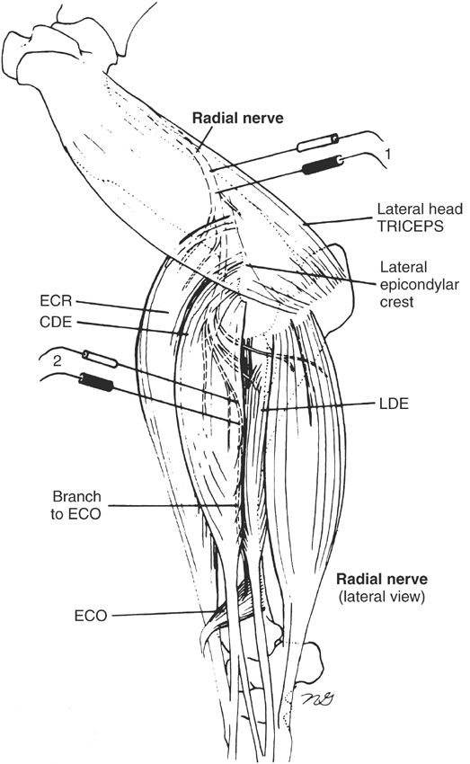 suprascapular nerve horse