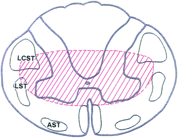 A184576_1_En_2_Fig2_HTML.gif