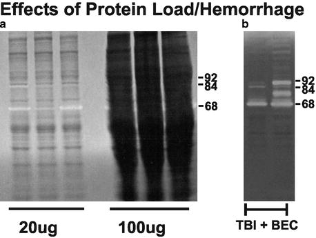 A194894_1_En_12_Fig1_HTML.jpg