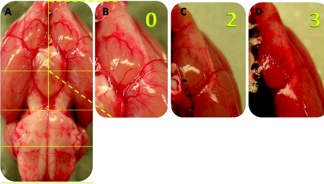 A194894_1_En_21_Fig2_HTML.jpg