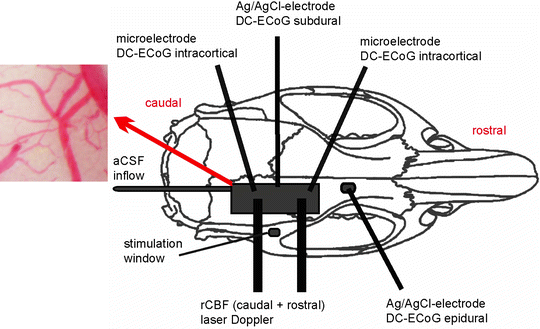 A194894_1_En_24_Fig2_HTML.gif