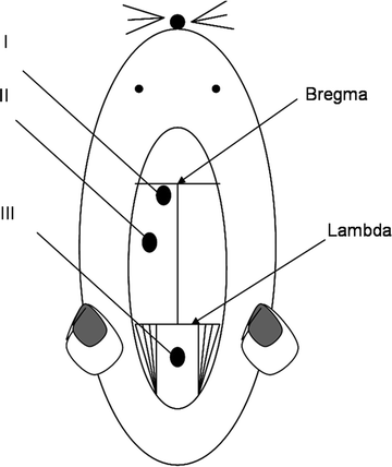 A194894_1_En_27_Fig1_HTML.gif