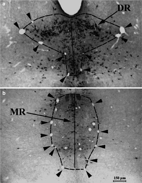 ideosyncratic cell distribution stereology