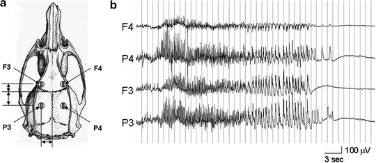 EEG, Evoked Potential, and Single-Unit Recordings In Vivo | Veterian Key
