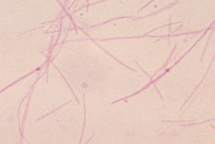 The Genus Fusobacterium | Veterian Key