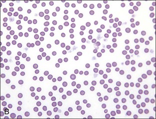 what is a normal red blood cell count in dogs