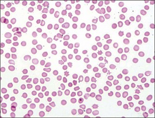 2: Red Blood Cells | Veterian Key