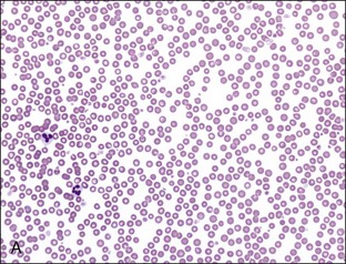 2: Red Blood Cells | Veterian Key