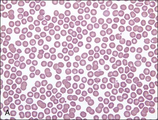 2: Red Blood Cells | Veterian Key