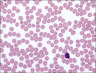 4: Platelets | Veterian Key