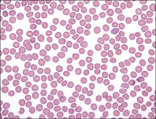 4: Platelets | Veterian Key