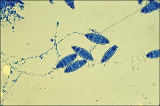 Image result for microsporum gypseum