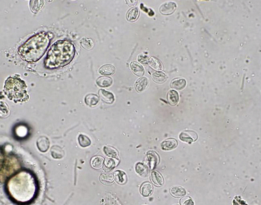giardia cytology
