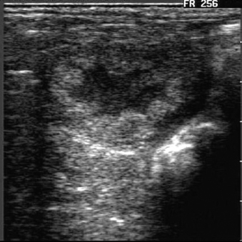 5. Transrectal Ultrasonography in Broodmare Practice | Veterian Key