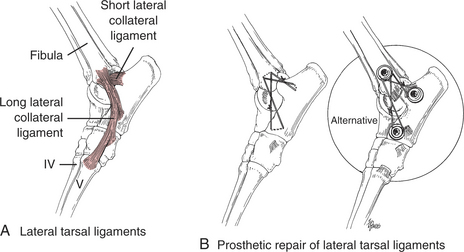 Luxation, Subluxation, and Shearing Injuries of the Tarsal Joint