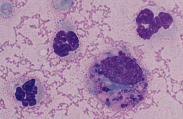 macrophages in synovial fluid