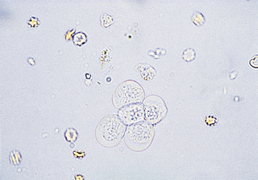 sediment urinary cells epithelial bladder unstained crenated examination cluster magnification rbcs 1120 several five figure original veteriankey