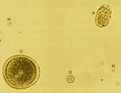 Enteric Coccidiosis Veterian Key