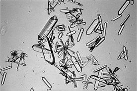 calcium phosphate crystals in urine sediment
