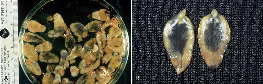 filo platyhelminthes osztályú trematoda