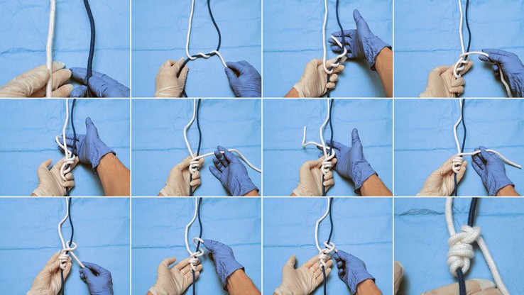 Minimally invasive knot-tying. (A) The knot-typing procedure starts