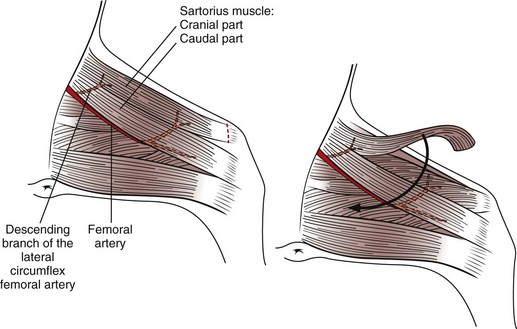 Sartorius Muscle Cat