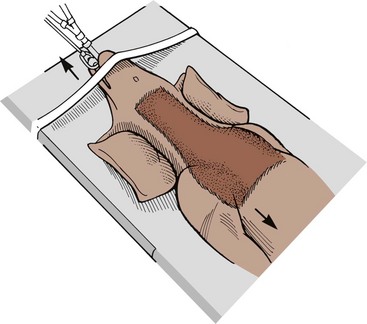 Ventral slot surgery canine cruciate