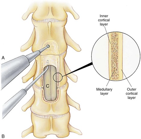 Ventral slot surgery canine treatment