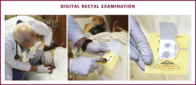Digital rectal examination. 