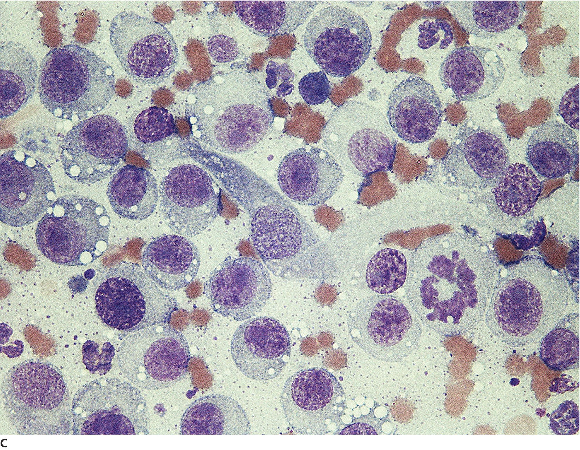 Mesenchymal Tumors Of The Skin And Soft Tissues | Veterian Key