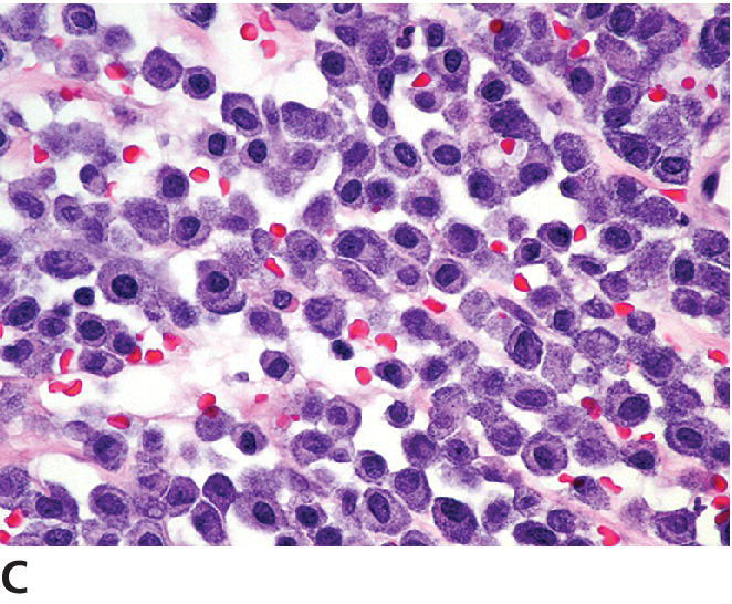 Mast Cell Tumors | Veterian Key