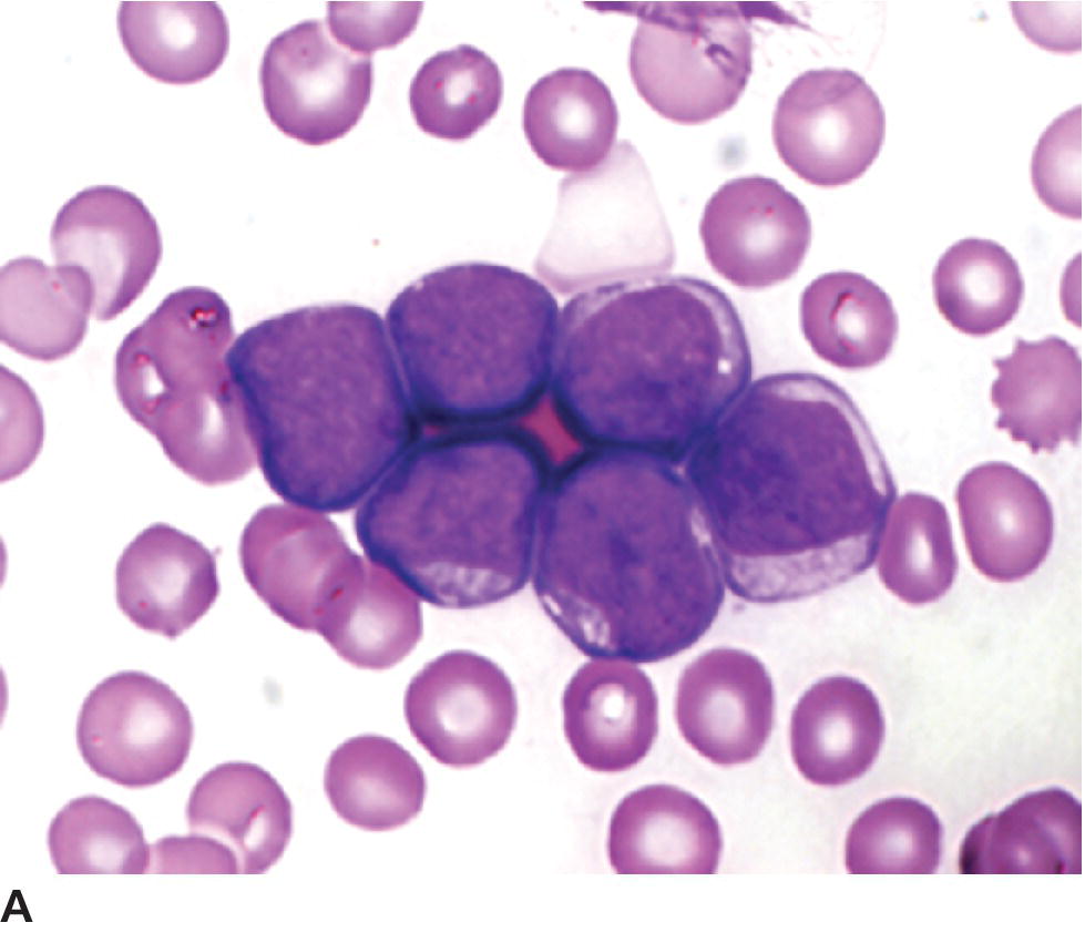 Tumors Of The Hemolymphatic System | Veterian Key