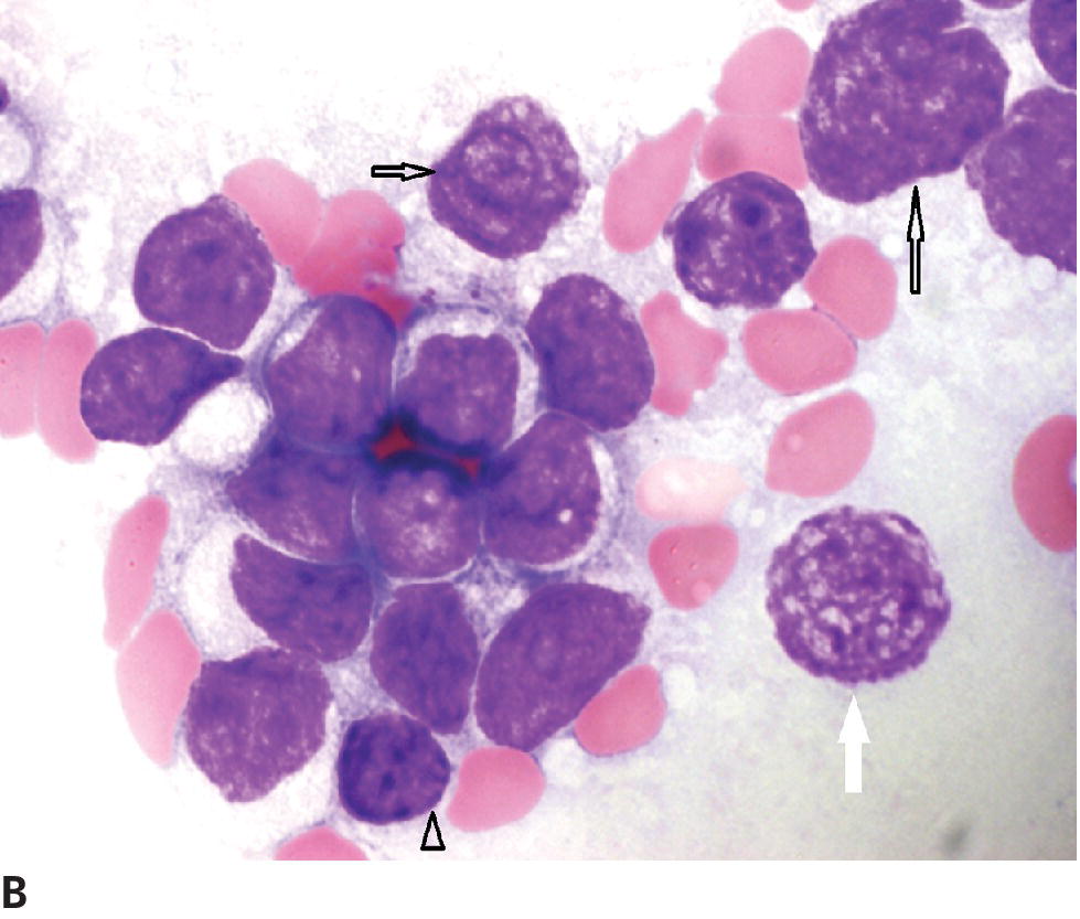 Tumors Of The Hemolymphatic System | Veterian Key