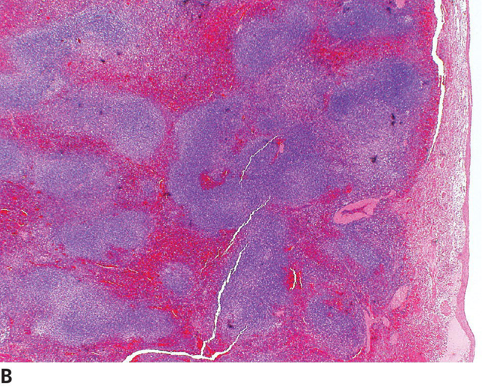 Tumors Of The Hemolymphatic System | Veterian Key