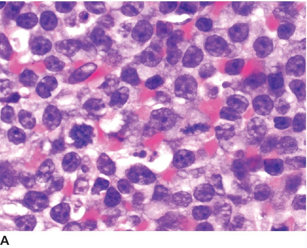 Tumors Of The Hemolymphatic System | Veterian Key