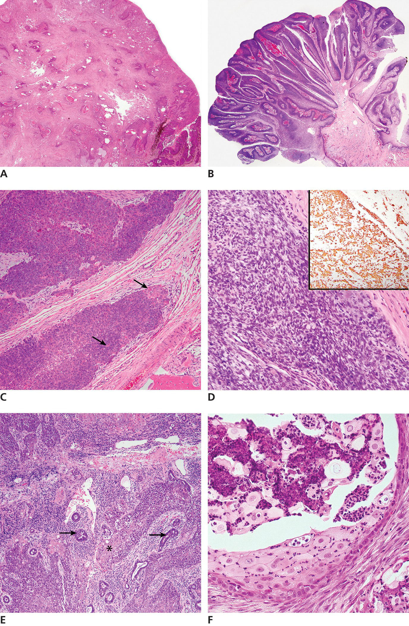 Tumors Of The Alimentary Tract | Veterian Key