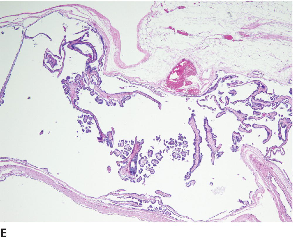 Tumors Of The Genital Systems | Veterian Key