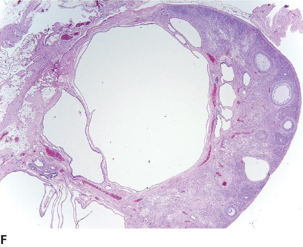 Tumors Of The Genital Systems | Veterian Key