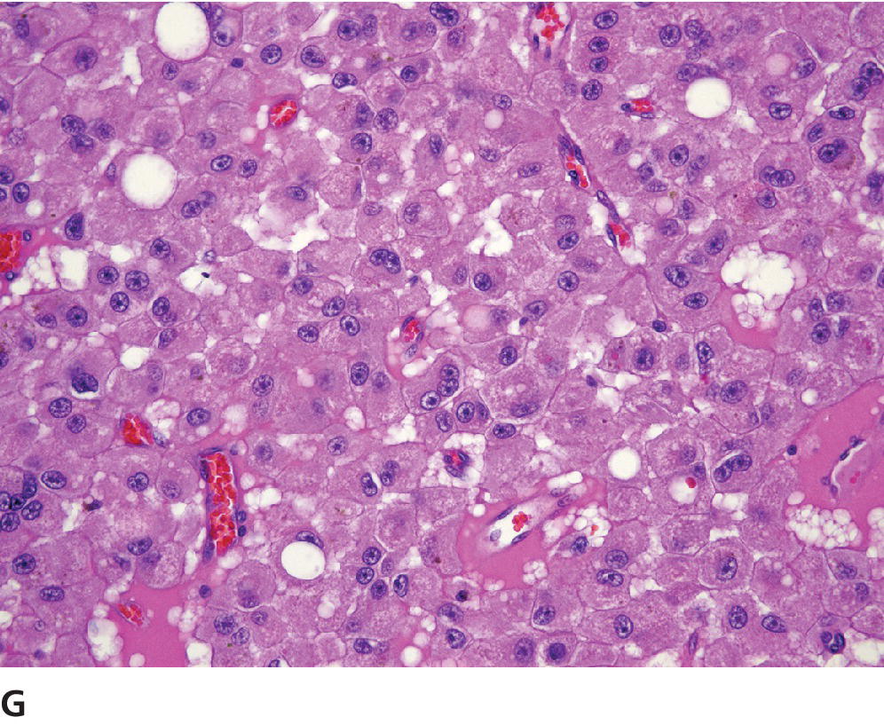 Tumors Of The Genital Systems | Veterian Key