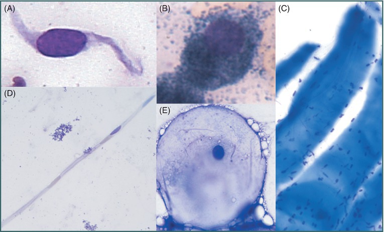 Epithelial Tumours | Veterian Key