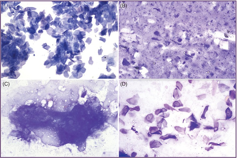 Cysts, Tumour-like Lesions And Response To Tissue Injury | Veterian Key