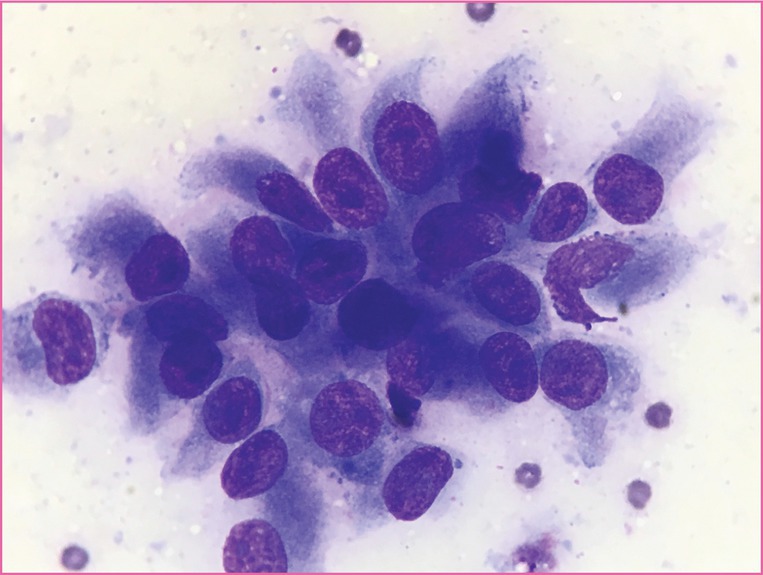 Round Cell Tumours | Veterian Key