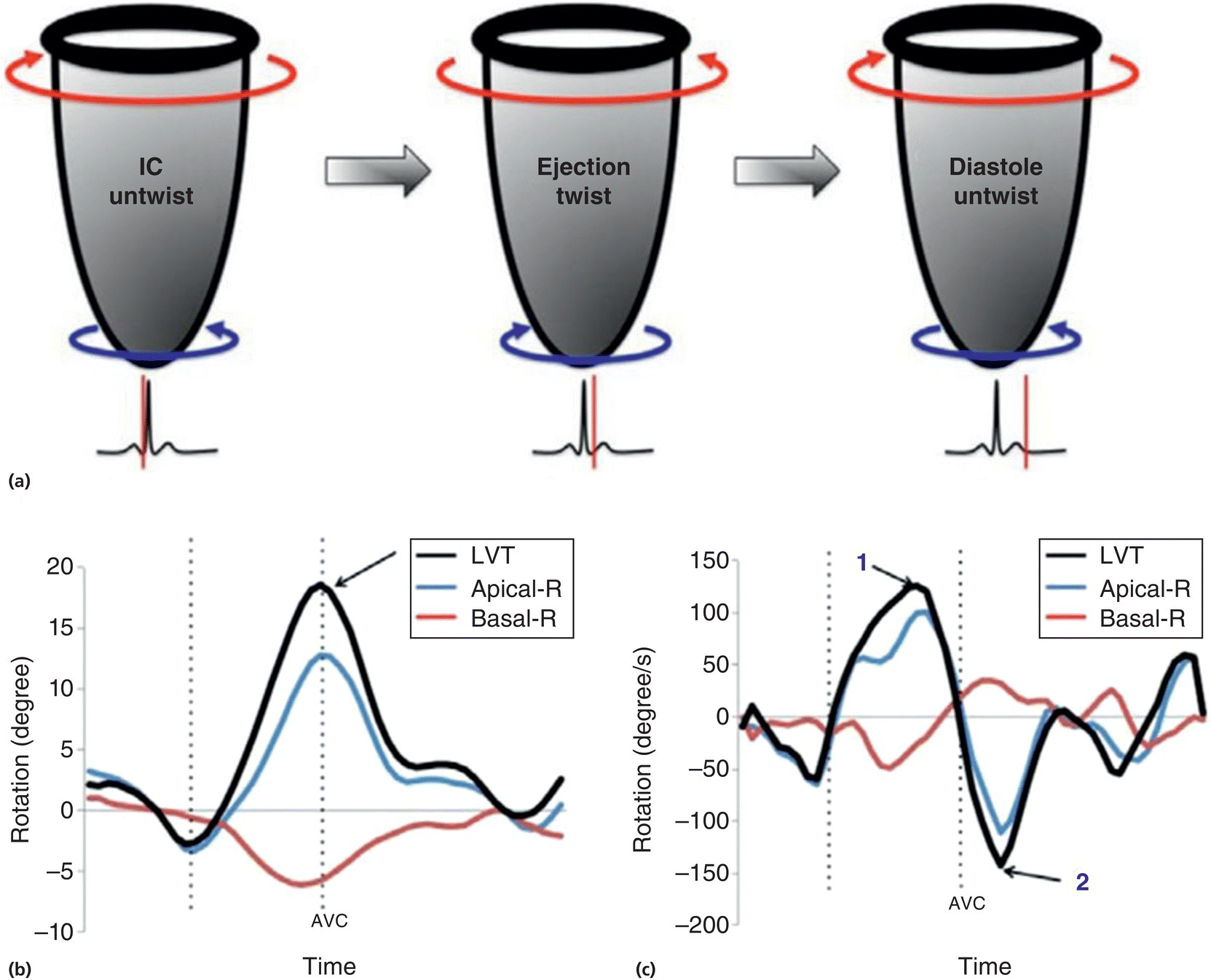 8: Diastolic Ventricular Function Assessment | Veterian Key