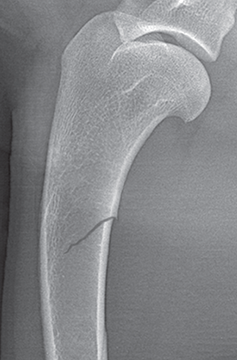 Photograph of torus fracture.