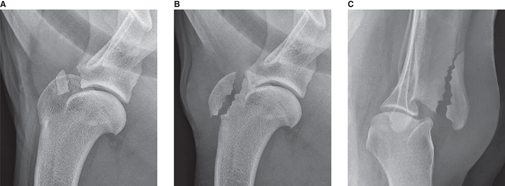 Photograph of avulsion fractures.