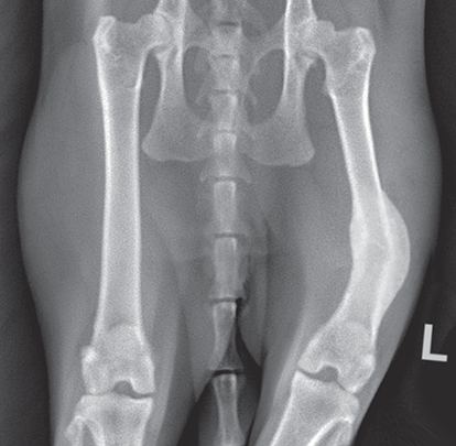 Photograph of malunion fracture.