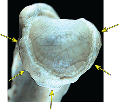 Photograph of osteophytes.