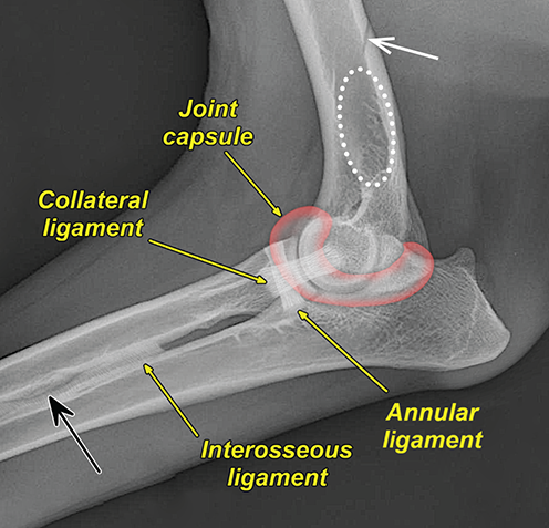 Photograph of normal elbow.